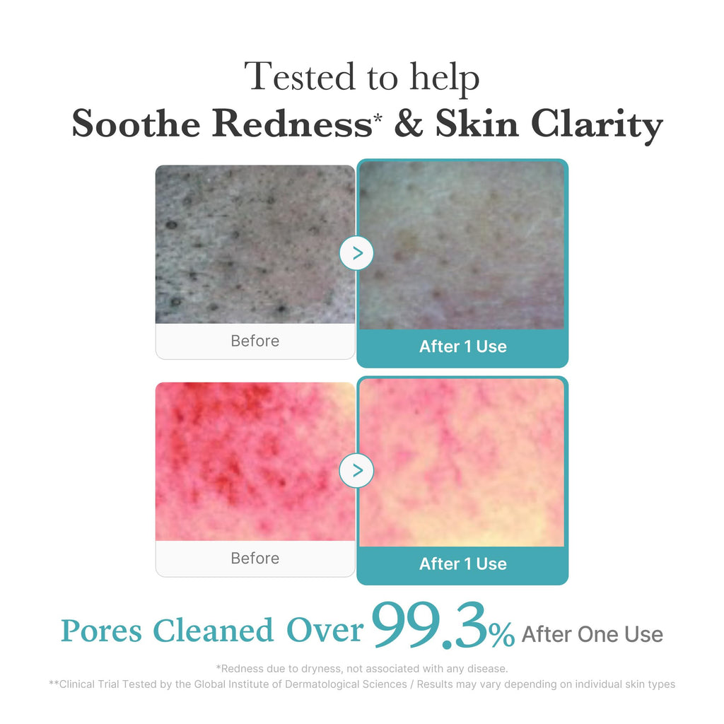 medicube Facial Cleanser Zero Pore Capsule Cleansing Foam | Daily Gentle Cleanser for Skin Texture, Blackhead & Pore Care | AHA, BHA & PHA for Deep Cleansing | Korean Skincare, 4.23 oz